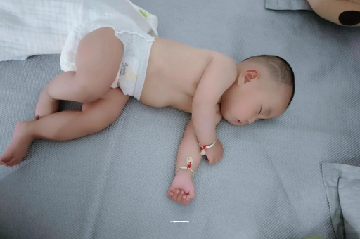 迪庆宝宝褶皱处擦粉还是油